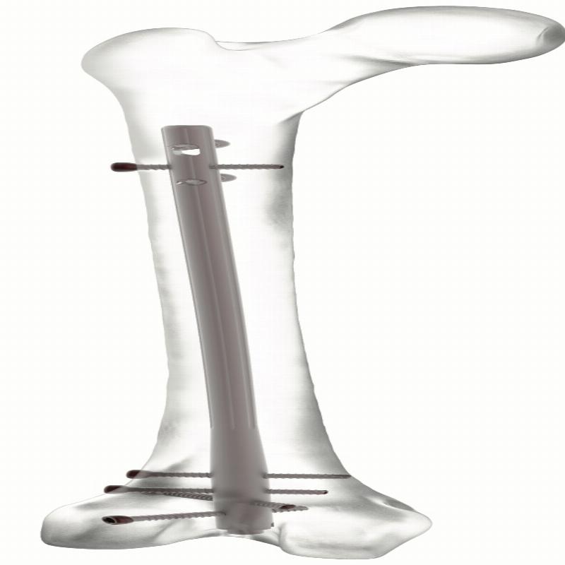 Auxein - Ретроградний Стегновий Стрижень